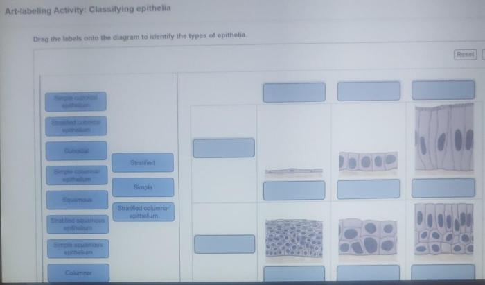 Art labeling activity classifying epithelia